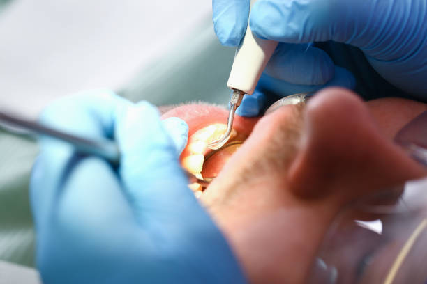 Best Emergency Gum Treatment in View Park Windsor Hills, CA